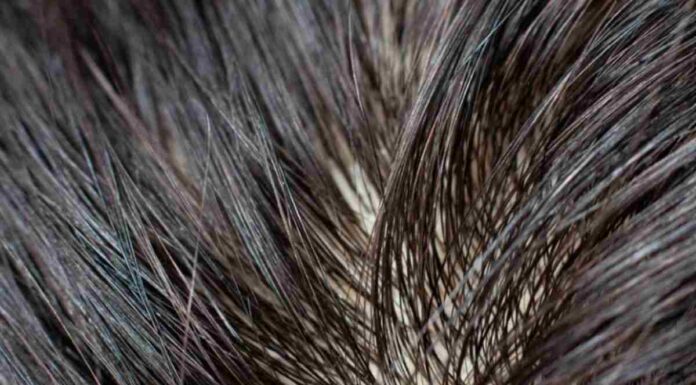 Capelli grassi, solo un brutto ricordo: nella dispensa l’ingrediente fenomenale per averli al top capelli grassi