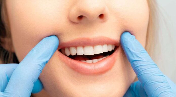 Denti bianchi come quelli di Miriam Leone: con questo prodotto hai lo stesso risultato a casa. Costa 3 euro denti bianchi come fare