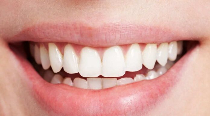 Denti più bianchi e sorriso wow in pochi minuti: i prodotti top consigliati dai dentisti denti bianchi