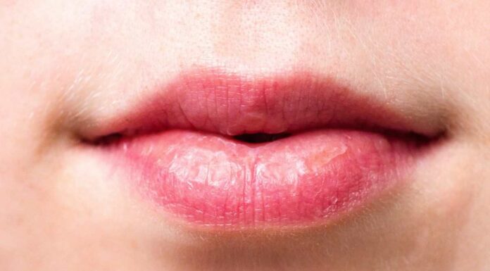 Labbra più piene e radiose all’istante: prova questo “filler” completamente naturale labbra carnose