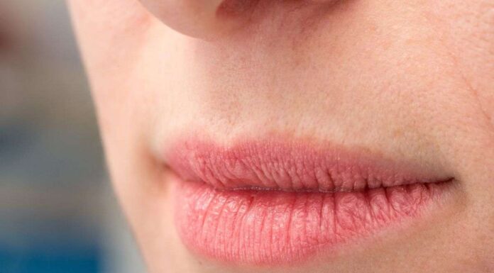 Basta labbra screpolate in inverno: i rimedi naturali e amici dell’ambiente (e del tuo portafoglio) labbra screpolate freddo rimedi