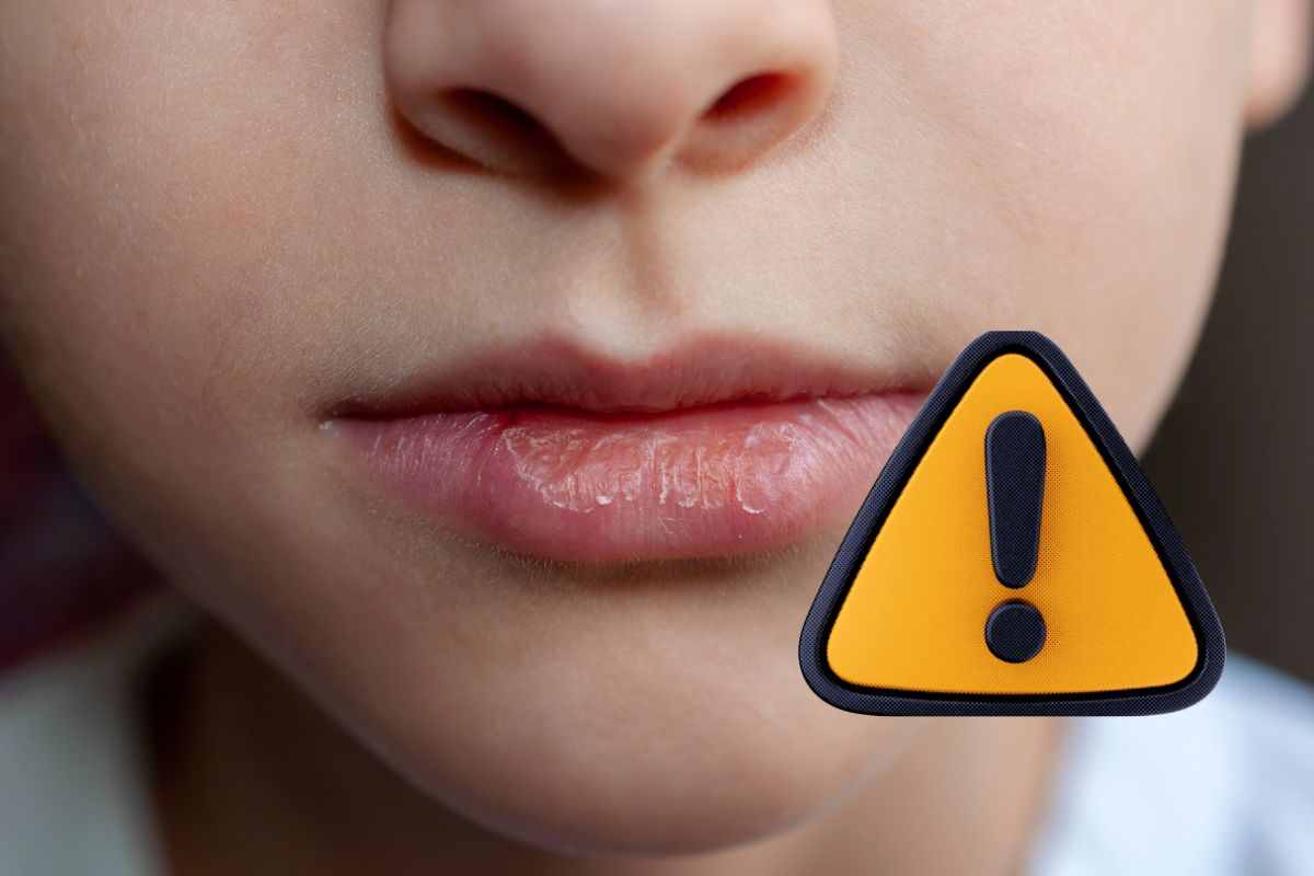 labbra screpolate la skincare