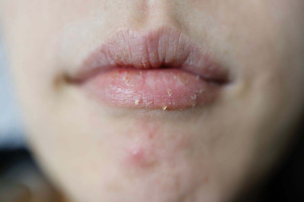 balsamo labbra a 6 euro contro le labbra secche