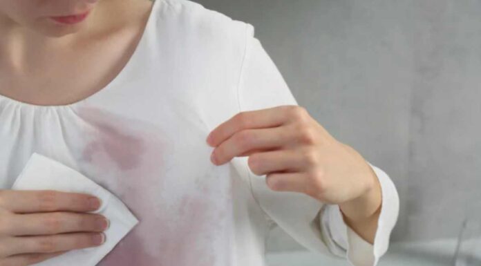 Hai rovesciato lo spumante? Il rimedio domestico che può salvare la serata e la giacca donna macchia spumante