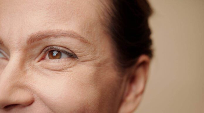 Pelle spenta, rughe e occhiaie: attenzione alle abbuffate delle feste. Cosa succede se mangi male abbuffate alla feste, attenzione causano danni al viso