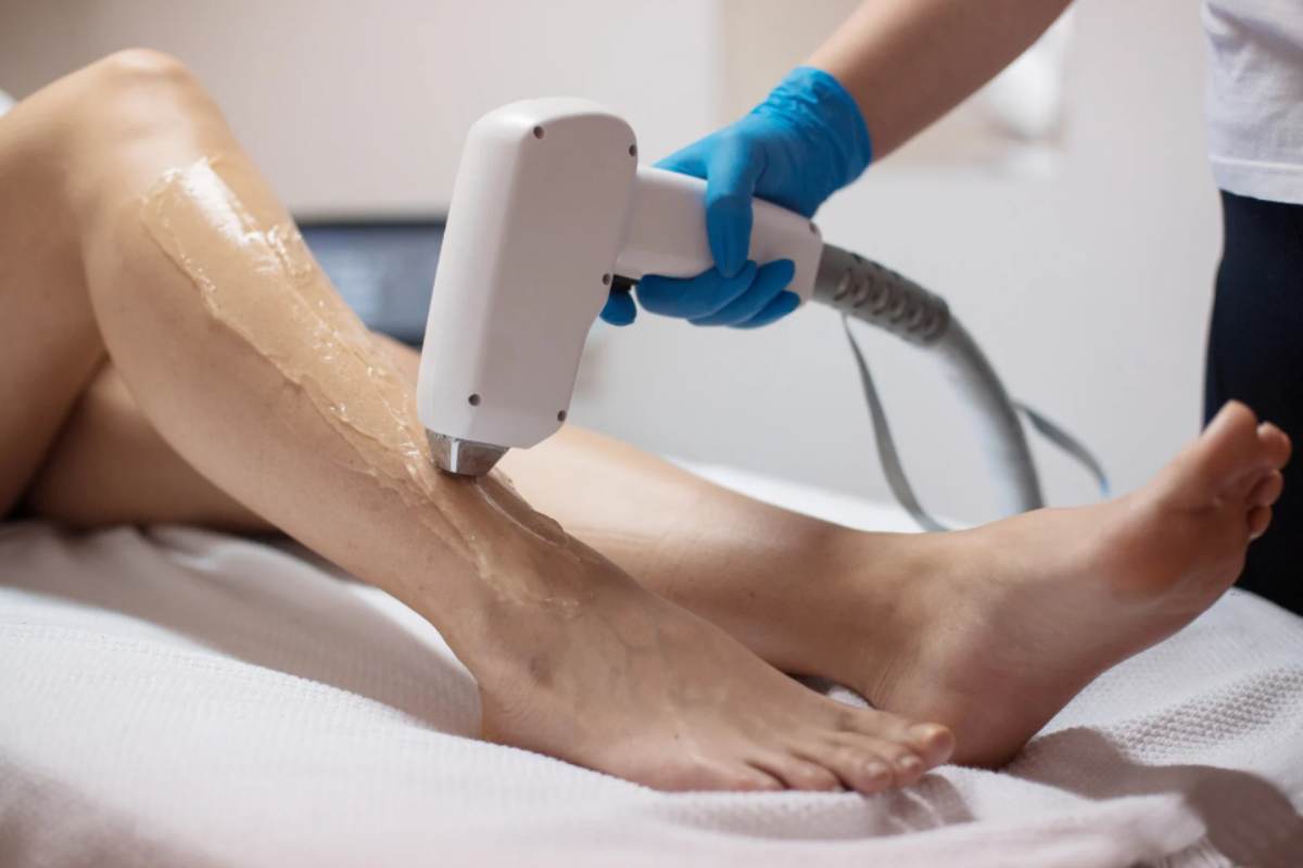 Epilazione Definitiva