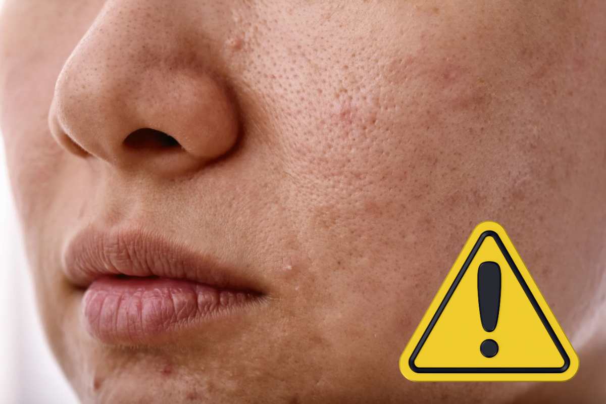 La tua pelle può predire le malattie prima ancora che tu te ne accorga: i segnali da non sottovalutare Pelle rovinata