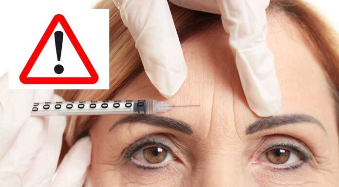“Notox”, la nuova frontiera della giovinezza è il trend più amato dalle star: viso fresco senza bisturi botox nuova frontiera