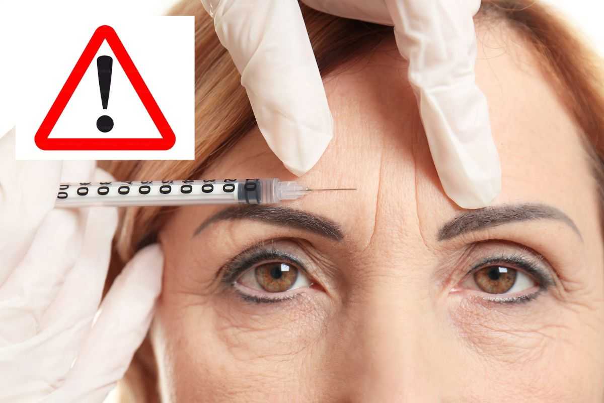 botox nuova frontiera