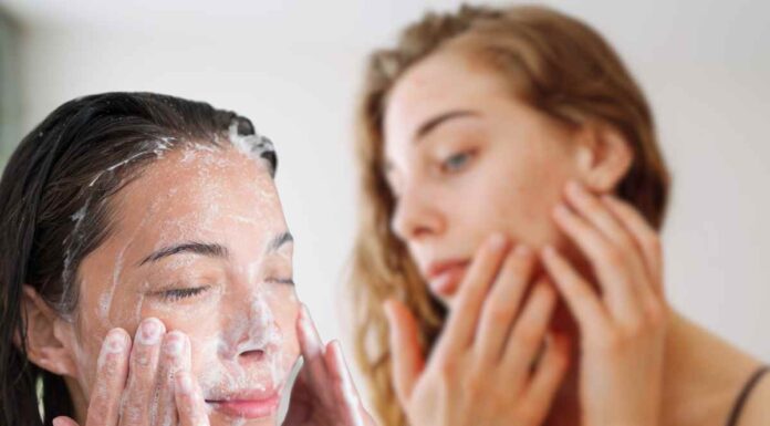 Dopo le feste la mia pelle era devastata, ho risolto con questo detergente magico pelle devastata detox