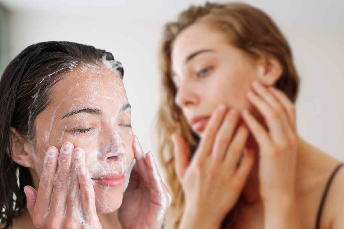 pelle devastata detox