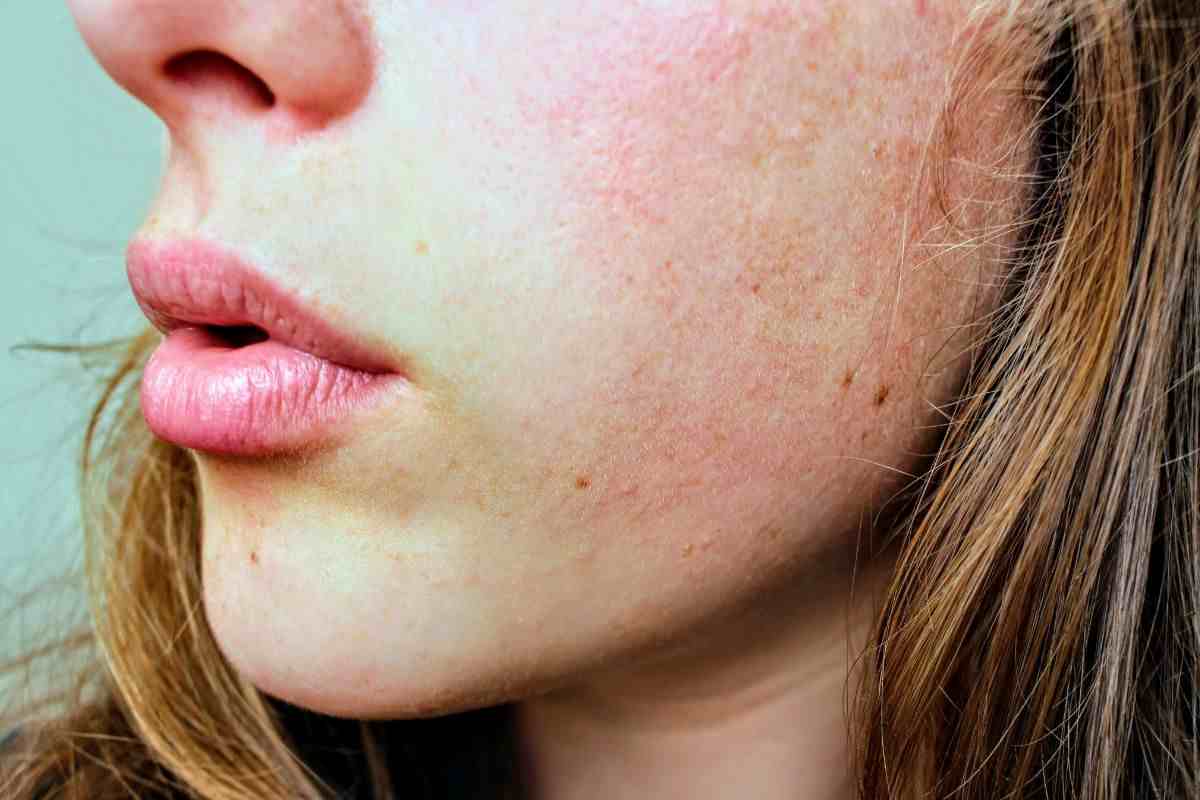 donna viso pelle secca