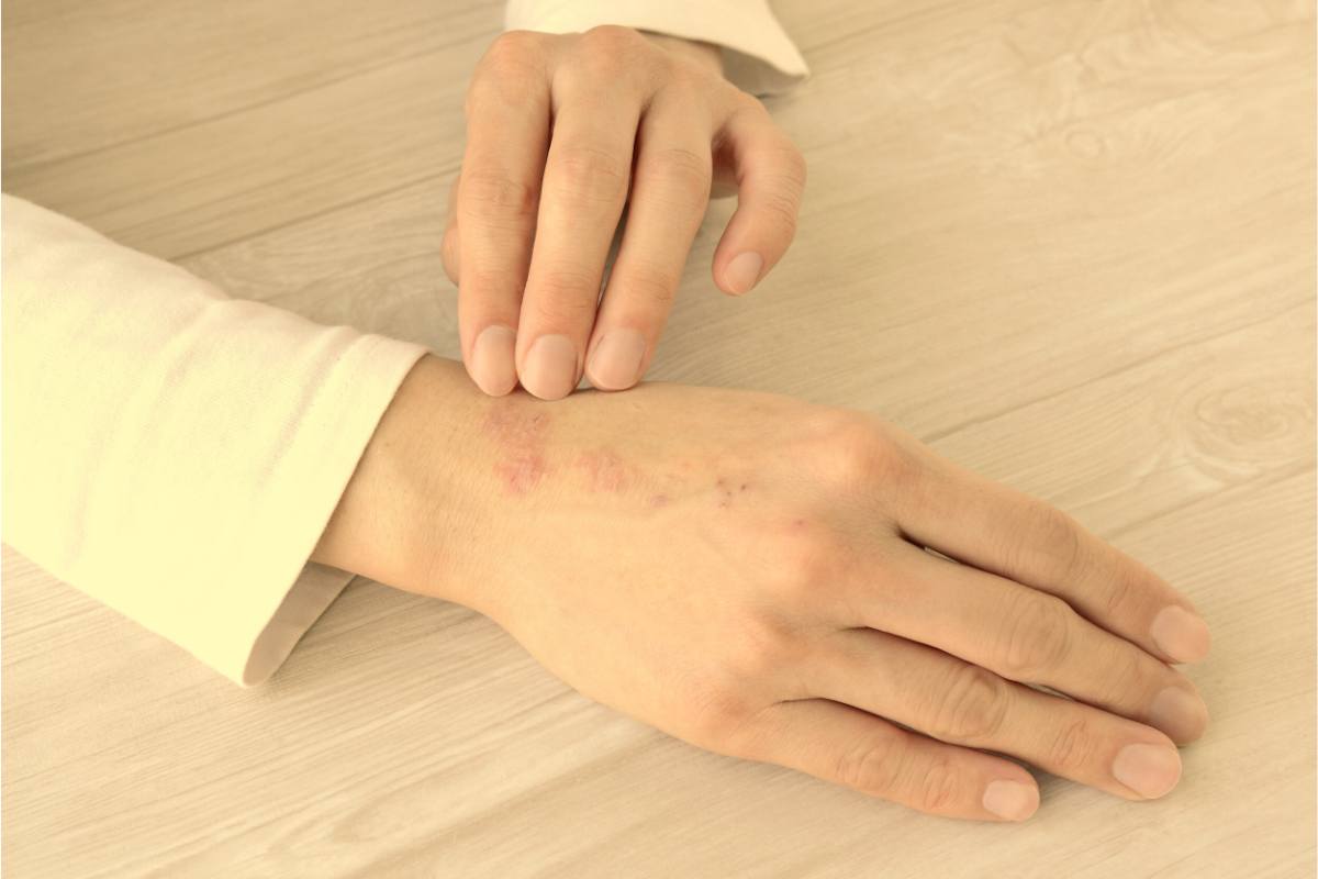 Mani spaccate dal freddo, devi curarle subito: 5 rimedi per averle morbide e soffici subito Mani spaccate dal freddo, devi curarle subito: 5 rimedi