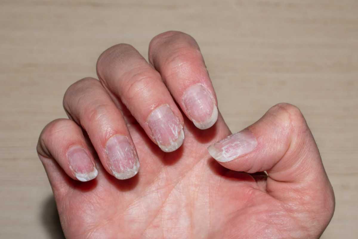 Unghie deboli e secche: la cura economica da fare ogni sera. Fa miracoli unghie deboli e secche