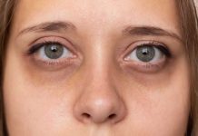 Borse sotto gli occhi, i cetrioli non servono: il trucco fai da te per eliminare occhiaie e gonfiori borse sotto occhi rimedi naturali