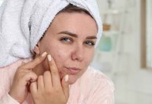 Lotta ai brufoli, in casa hai l’ingrediente per farli sparire subito: è facilissimo rimedi naturali per brufoli